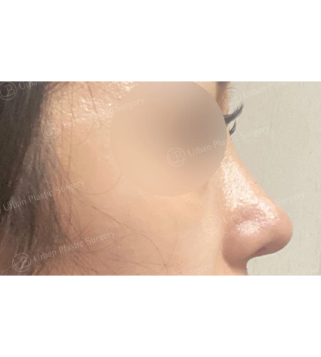 87545d7612155abf8ae5608ab8b29cf0_1747876007_2427.png