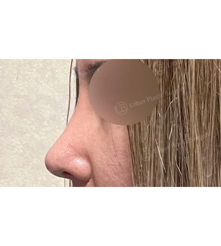 967fbda011197ed36fce34123e094324_1747098679_4924.png