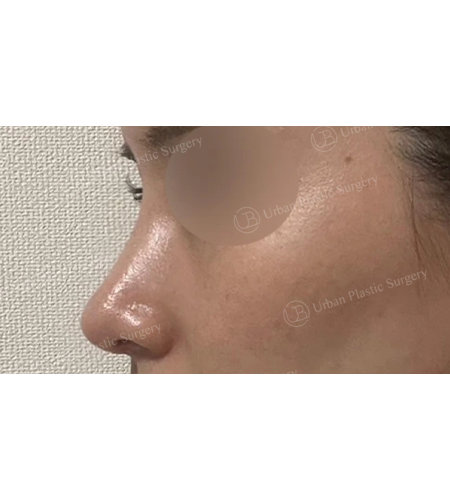 c868038e745670ab0c7094f4a1e64b13_1747185320_2735.png