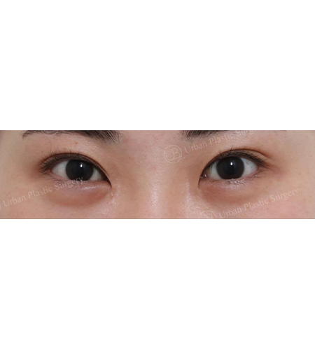 f8bc67dd728abb6ba51e2e9b79d3e80e_1749693392_9424.png