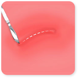 Step 02
