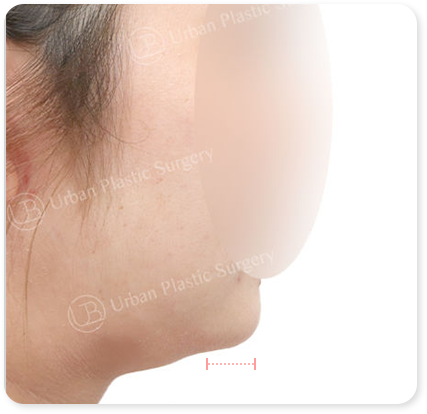 Case 01