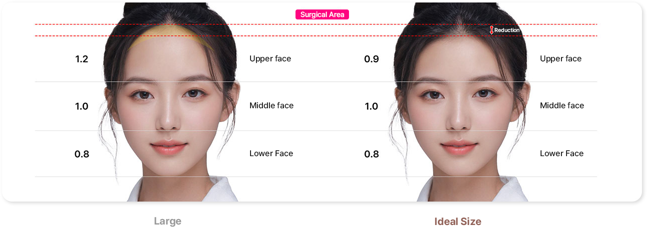 surgical area