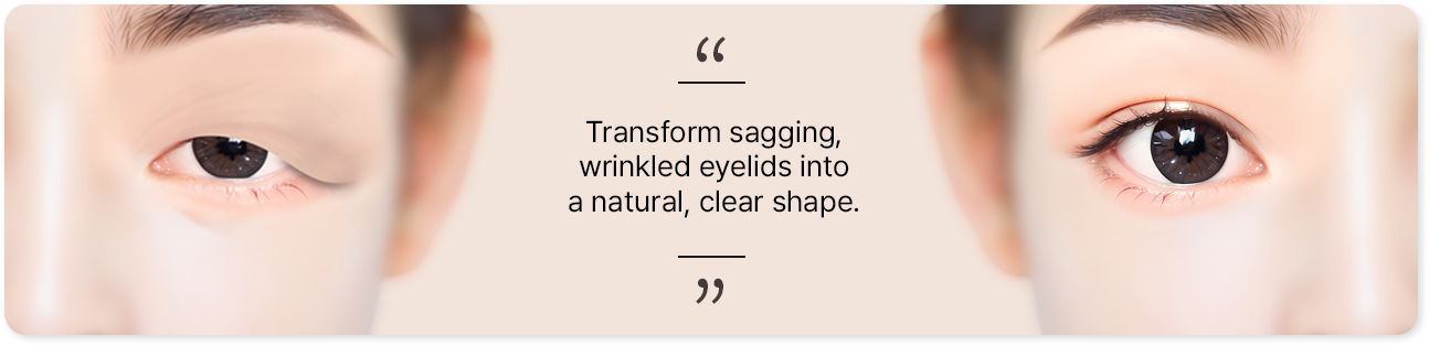 Transform sagging, wrinkled eyelids into a natural, clear shape.