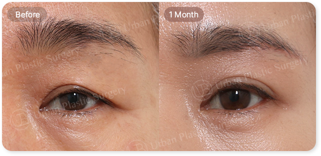 before, 1 month