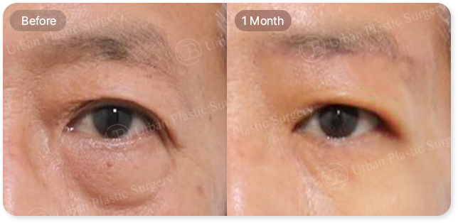 before, 1 month