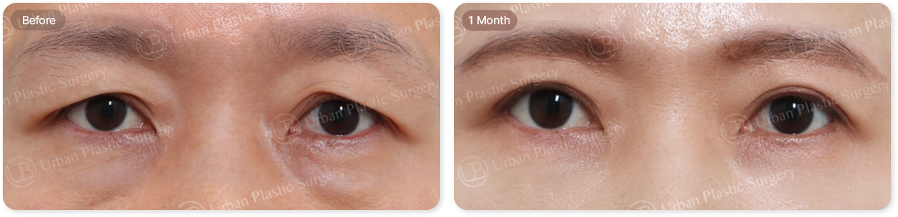 before, 1 month