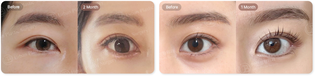before, 2month, before, 1month