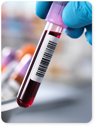 Blood Test