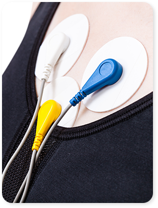 ECG (Electrocardiogram)